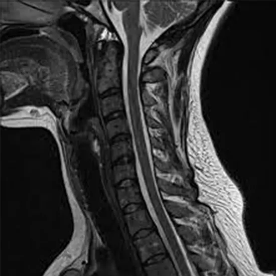 What Is Neck MRI and What Is The Cost Of Neck MRI